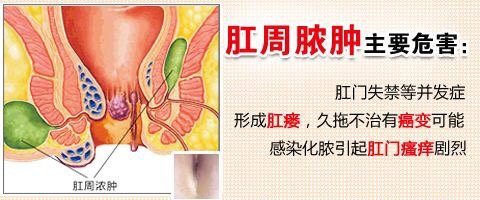 病人先感到肛门周围出现了一个小硬块或肿块,剧烈疼痛,红肿发热,坠胀