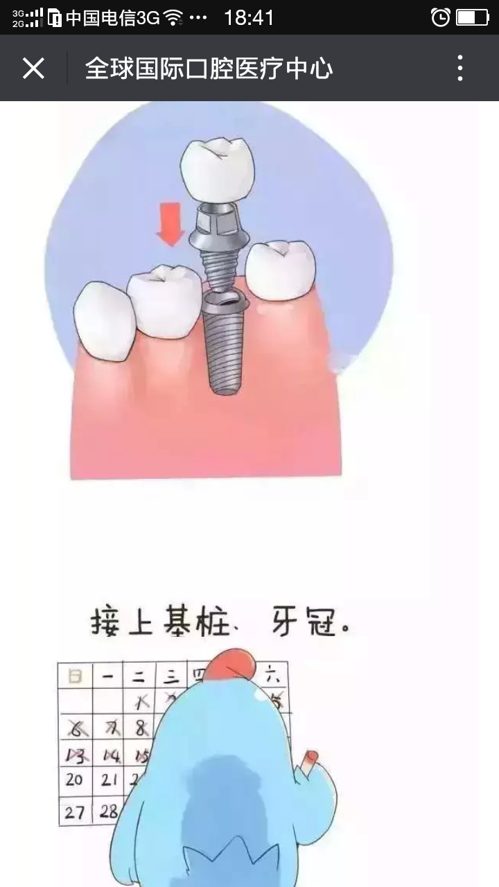 种植牙漫画,助你了解种植牙(转载) - 好大夫在线
