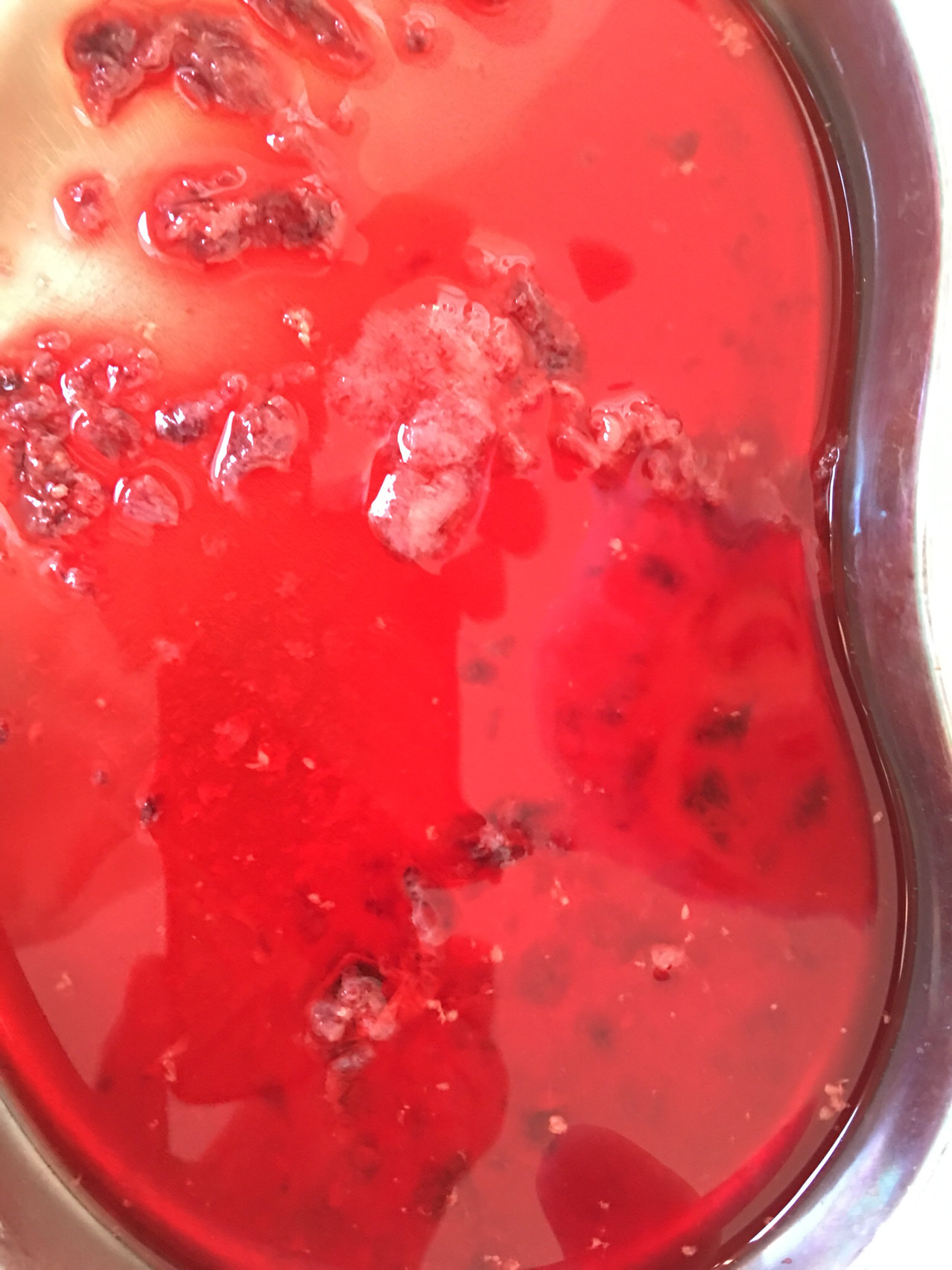 β-hCG 升高不一定都是怀孕