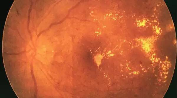 眼部疾病_症状_相关疾病 - 好大夫在线