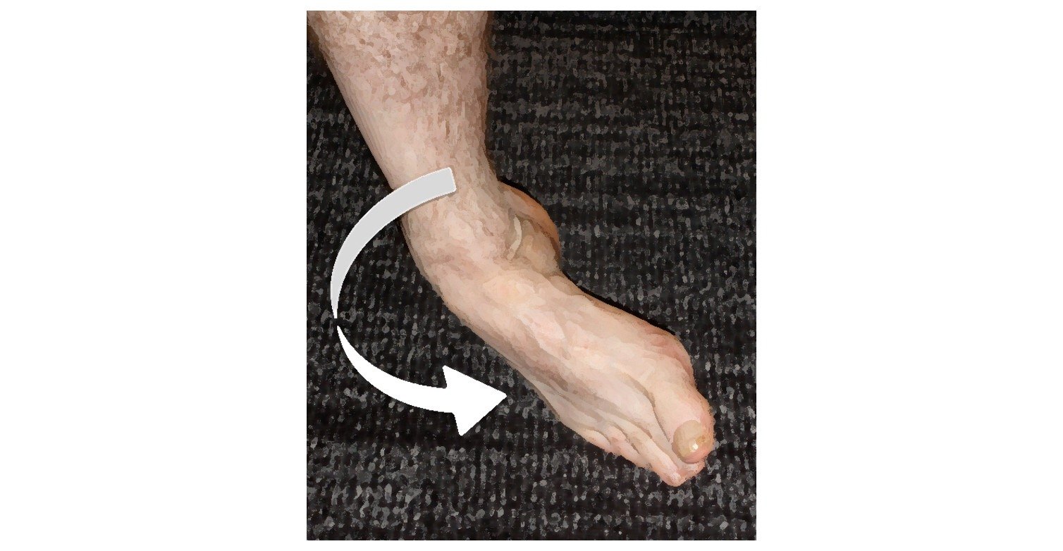 跳舞也能跳骨折? - 好大夫在线