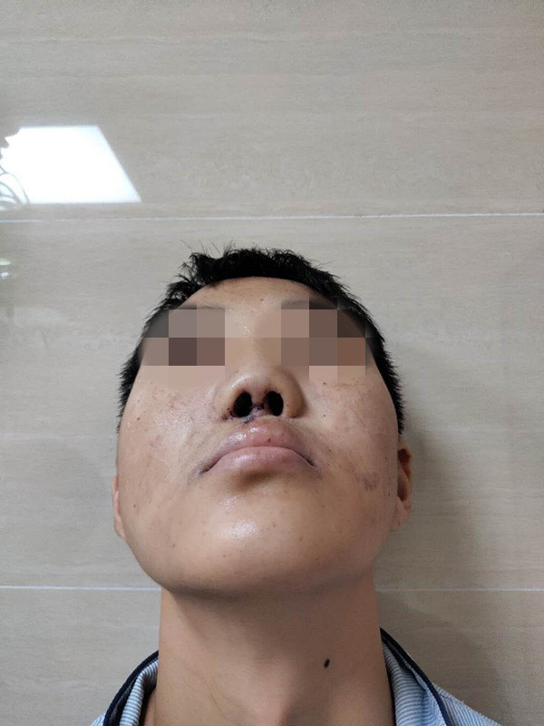 關于擅長:顏面骨外傷及面部輪廓整復、鼻唇畸形整復、手部燒創傷急救及先天后遺畸形治療與功能重...號販子聯系方式_誠信第一,服務至上!的信息 關于擅長:顏面骨外傷及面部輪廓整復、鼻唇畸形整復、手部燒創傷急救及先天后遺畸形治療與功能重...號販子聯系方式_誠信第一,服務至上!的信息