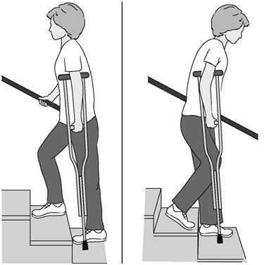 美国aaos全膝关节置换术后功能锻炼指南 