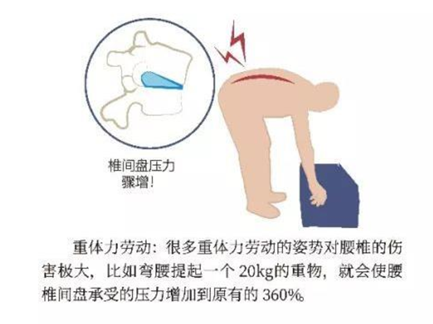 什么原因会引起腰酸痛 w4YBAFxDEWOASdSeAAGvMwBWkx4086.png?_ms_=4dce