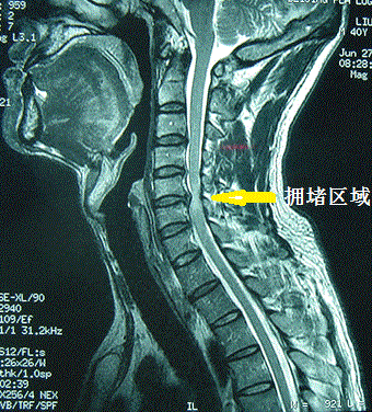 高速路拥堵区域.gif