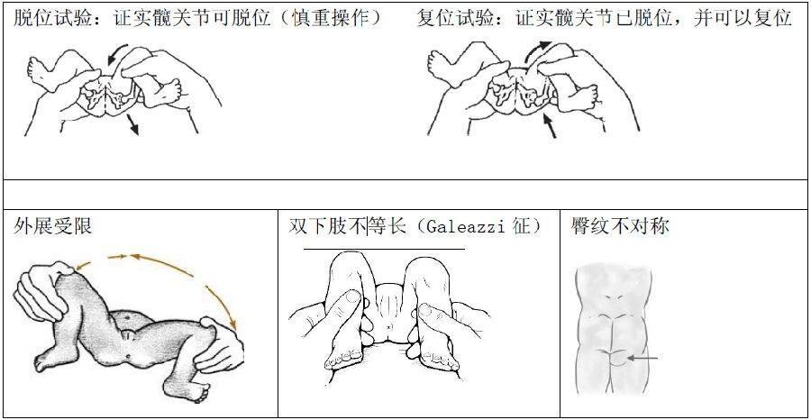 注意了,宝宝学走晚或走不稳,警惕发育性髋关节脱位