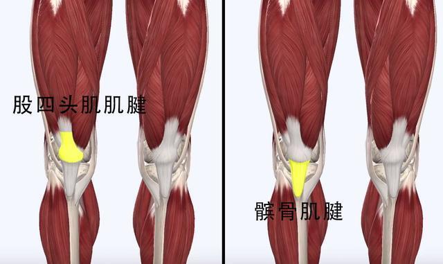 膝盖上方疼痛 警惕股四头肌腱炎 膝关节损伤