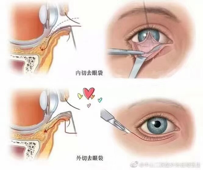 圖文圖片