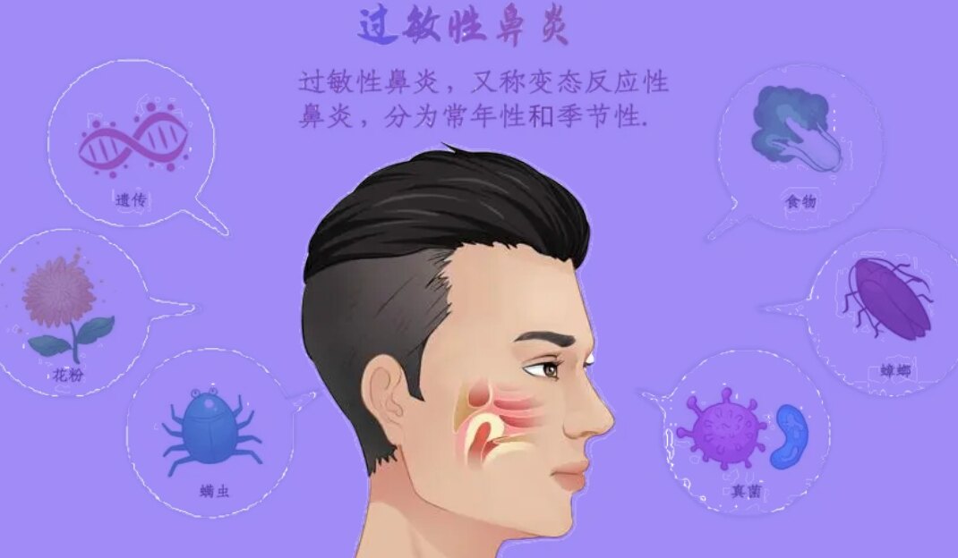圖文圖片