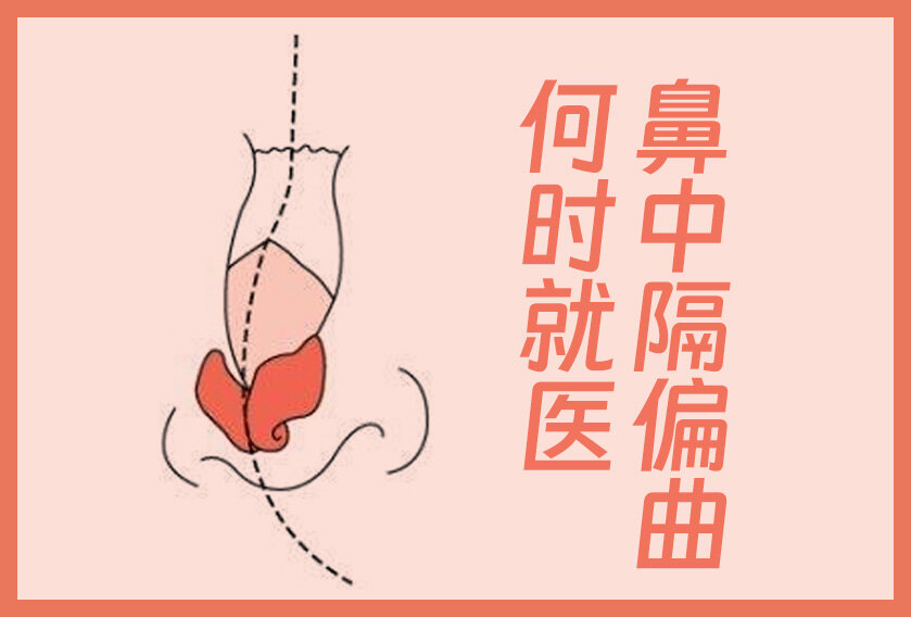 圖文圖片