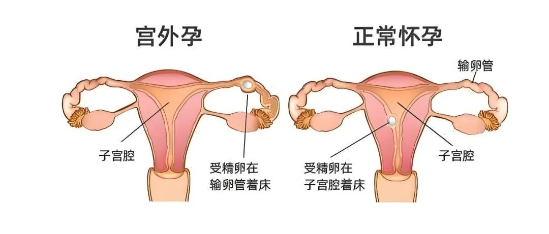 圖文圖片