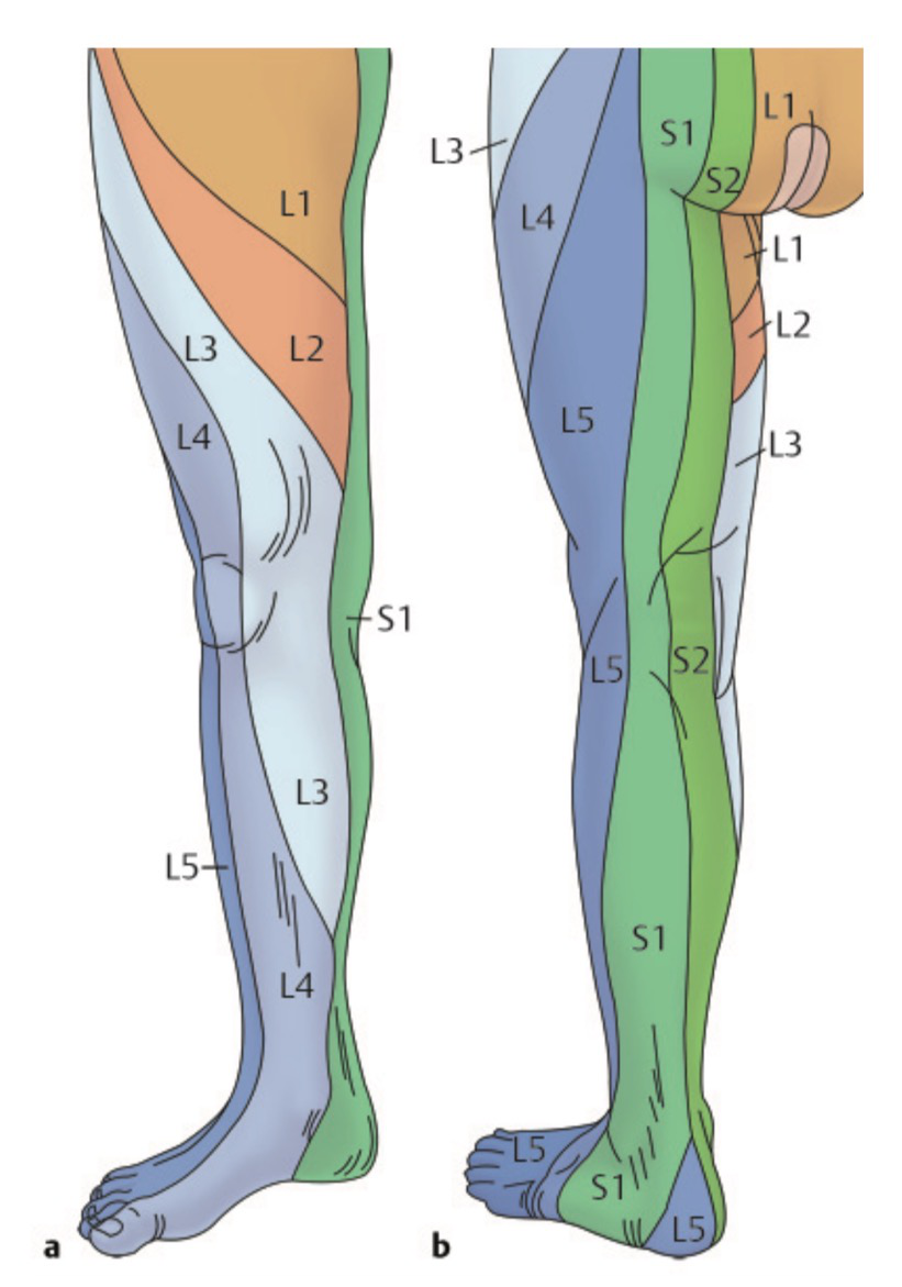 不同节段(腰4~骶1)椎间盘压迫神经,疼痛部位不同比如说腿疼,就要说