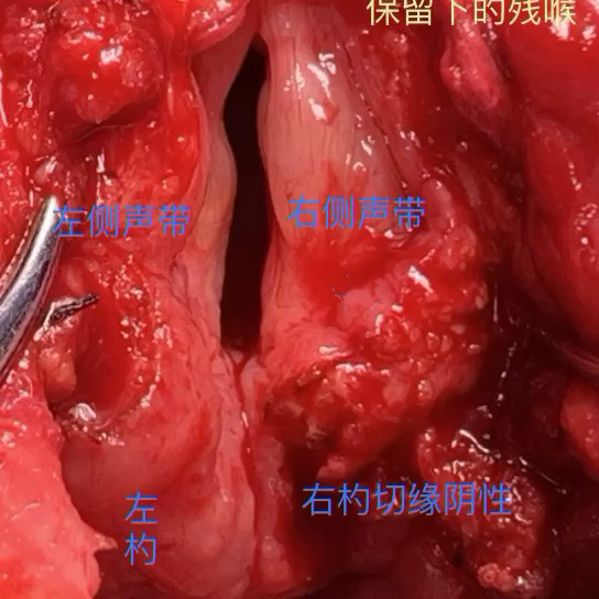 視頻封面