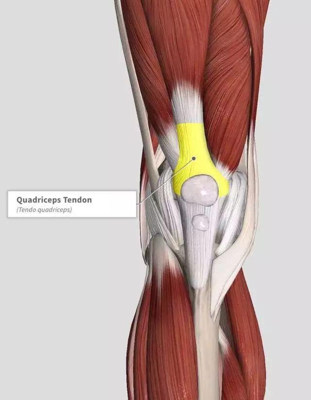 膝盖上方疼痛警惕股四头肌腱炎