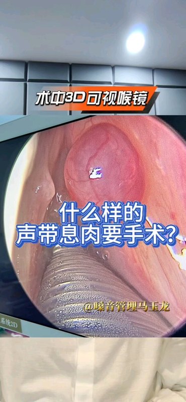 視頻封面
