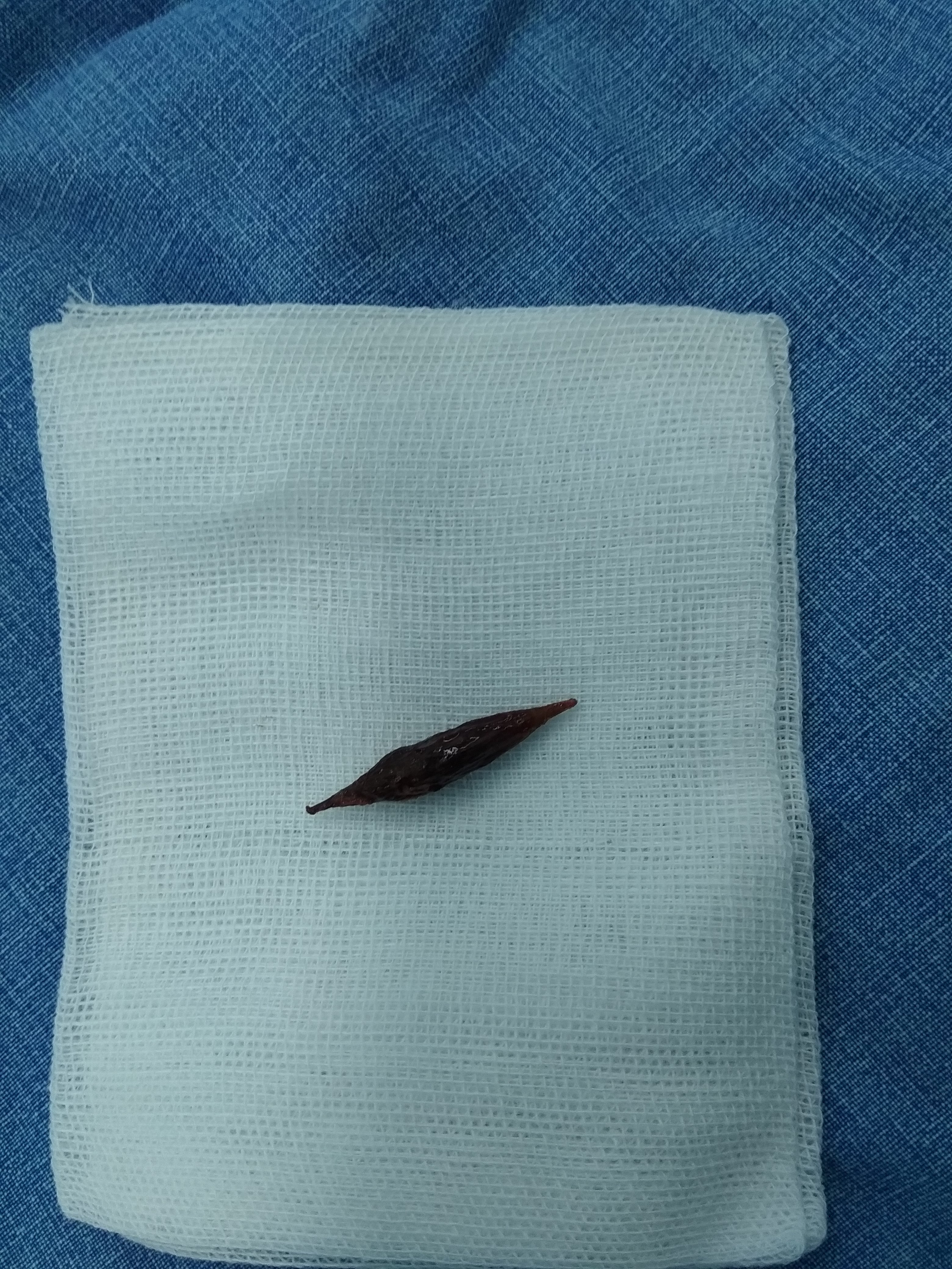 10厘米长的异物肛门图片