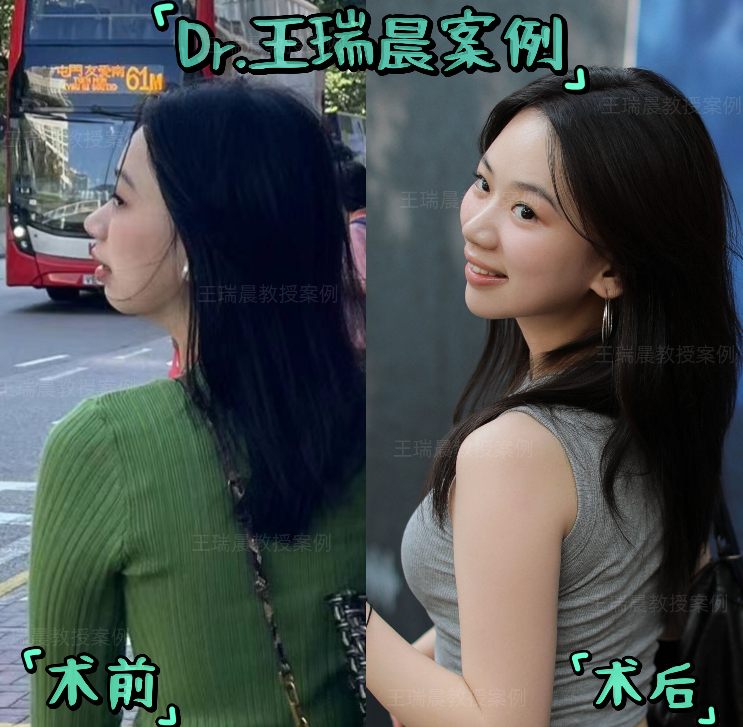 圖文圖片