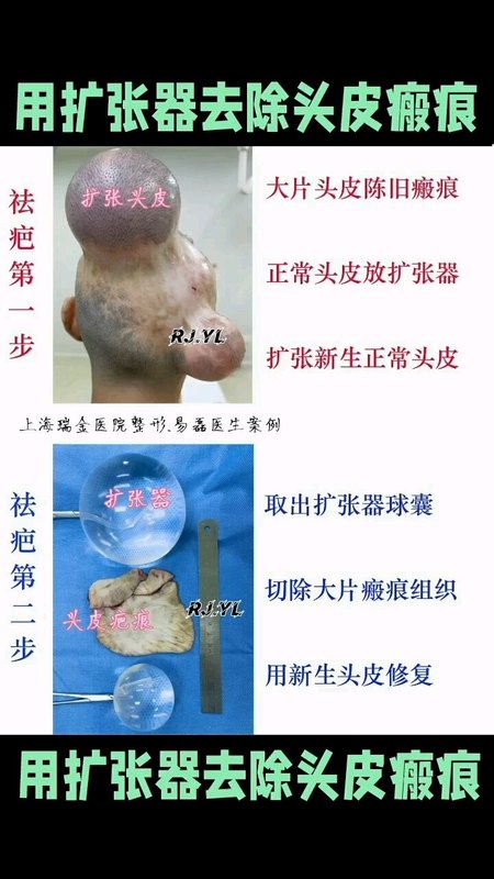 視頻封面