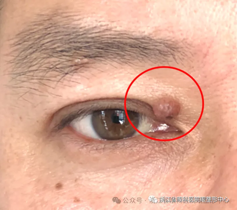 圖文圖片