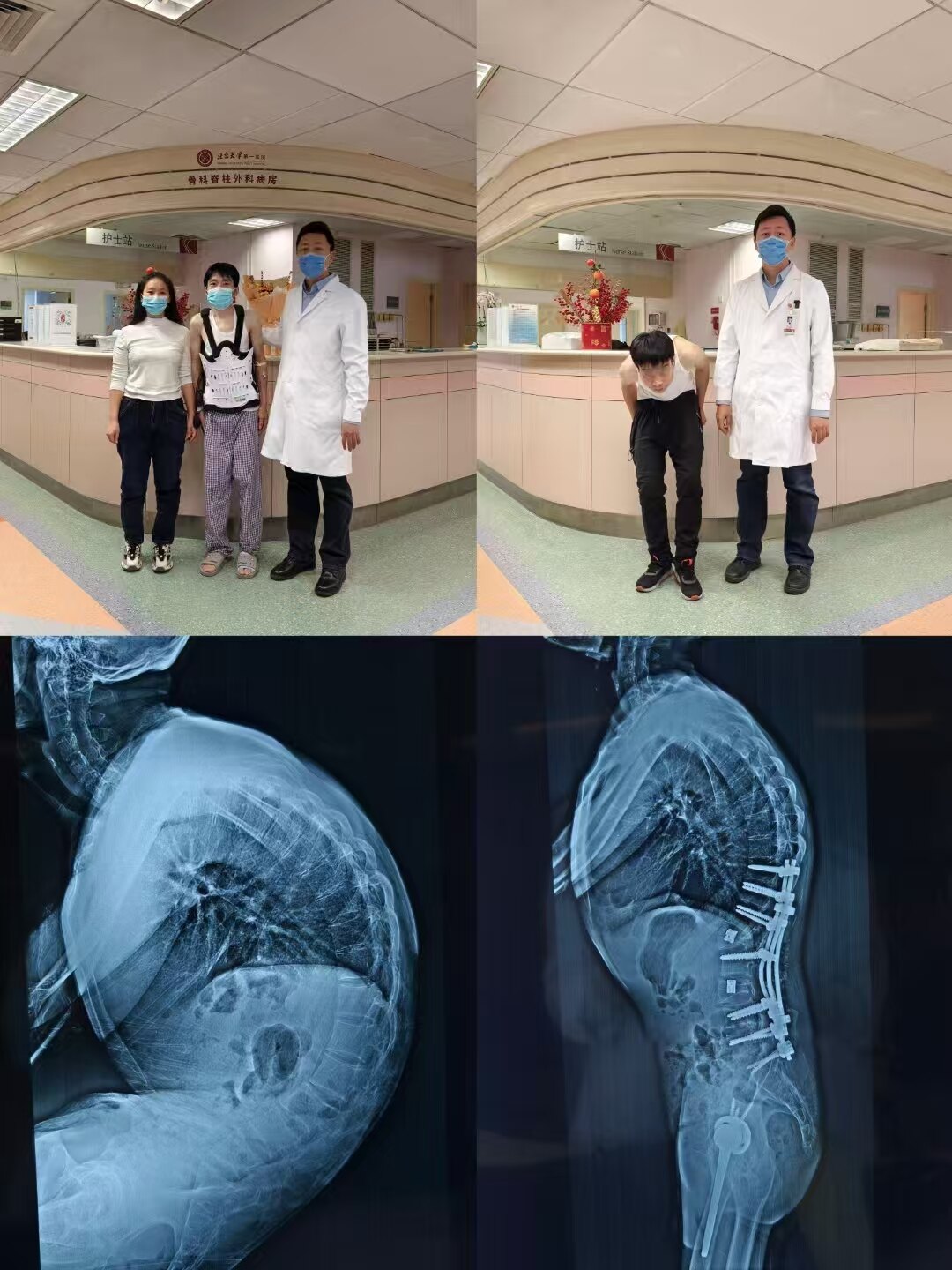 强直2.jpg