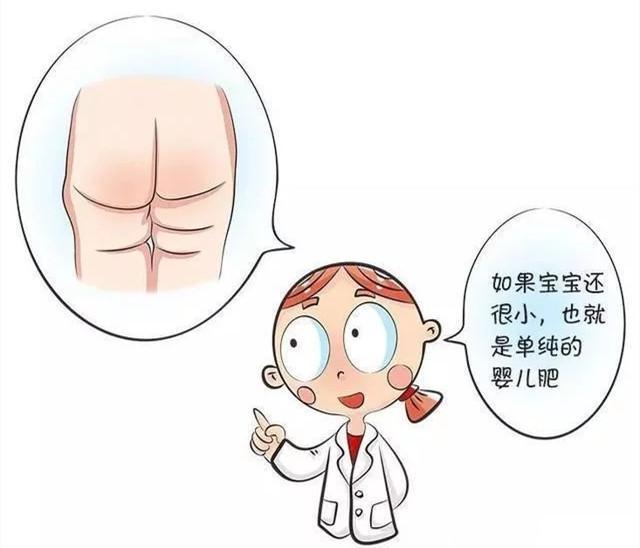 宝宝两侧腿纹不同也是病吗?