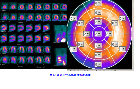 醫院裡的核醫學科到底是幹什麼的