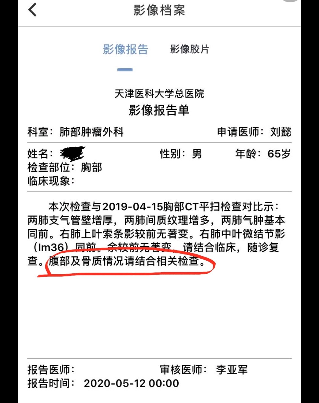 ct報告中的腹部和骨質情況請結合相關檢查什麼意思