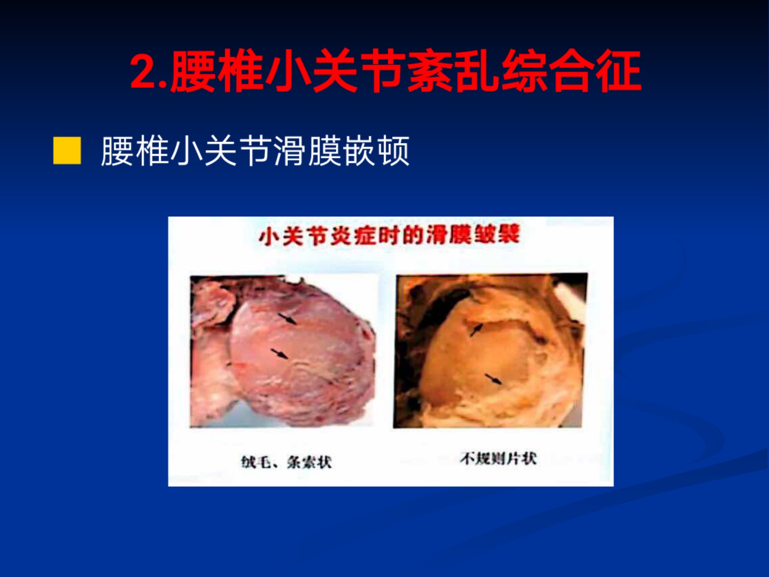 浅谈腰痛(1)_11.jpg