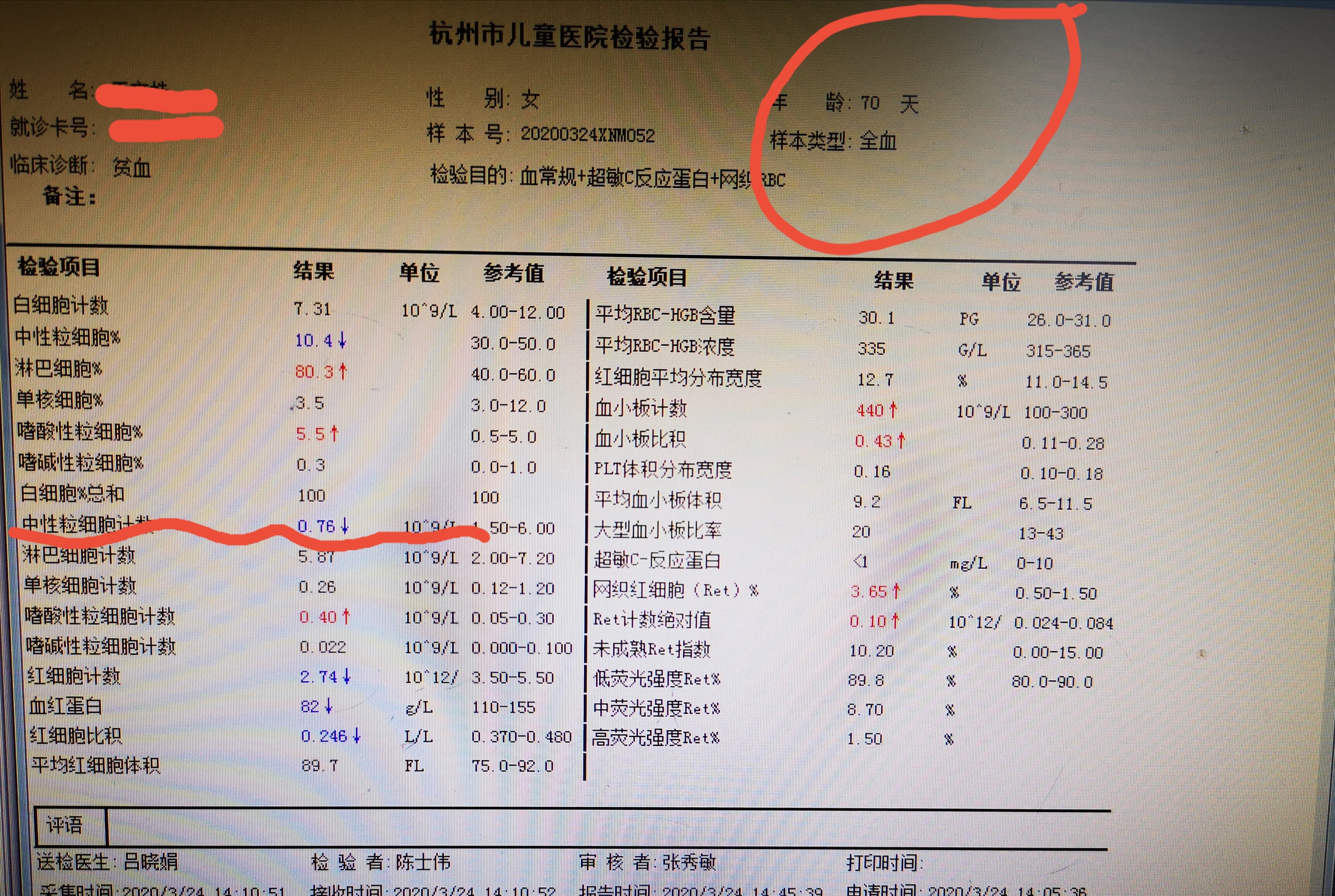 单核细胞百分比偏高血红蛋白偏低的原因_蛋白细胞偏低的原因_蛋白比例偏低