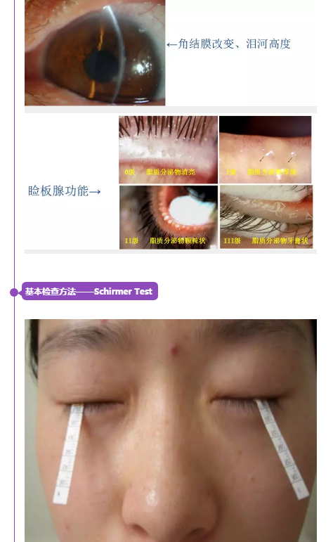 郭海科眼科继教干眼的诊疗规范