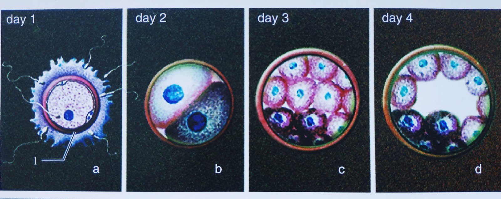 怀孕早期用药的"全"或"无"效应