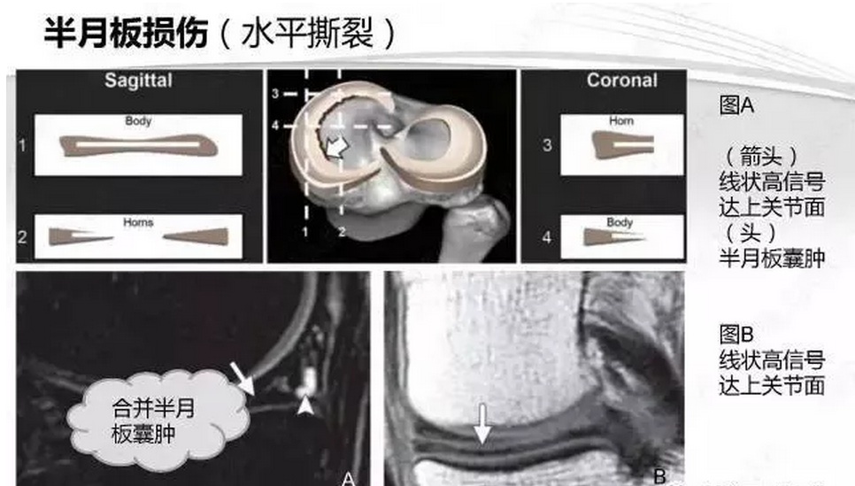 骨科;浙江大學骨科研究所;浙江大學李達三·葉耀珍再生醫學發展基金