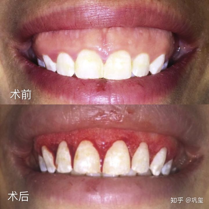 1539655528305854.jpg v2-551d4e54d9f78025d331c493e9c9752f_hd.jpg