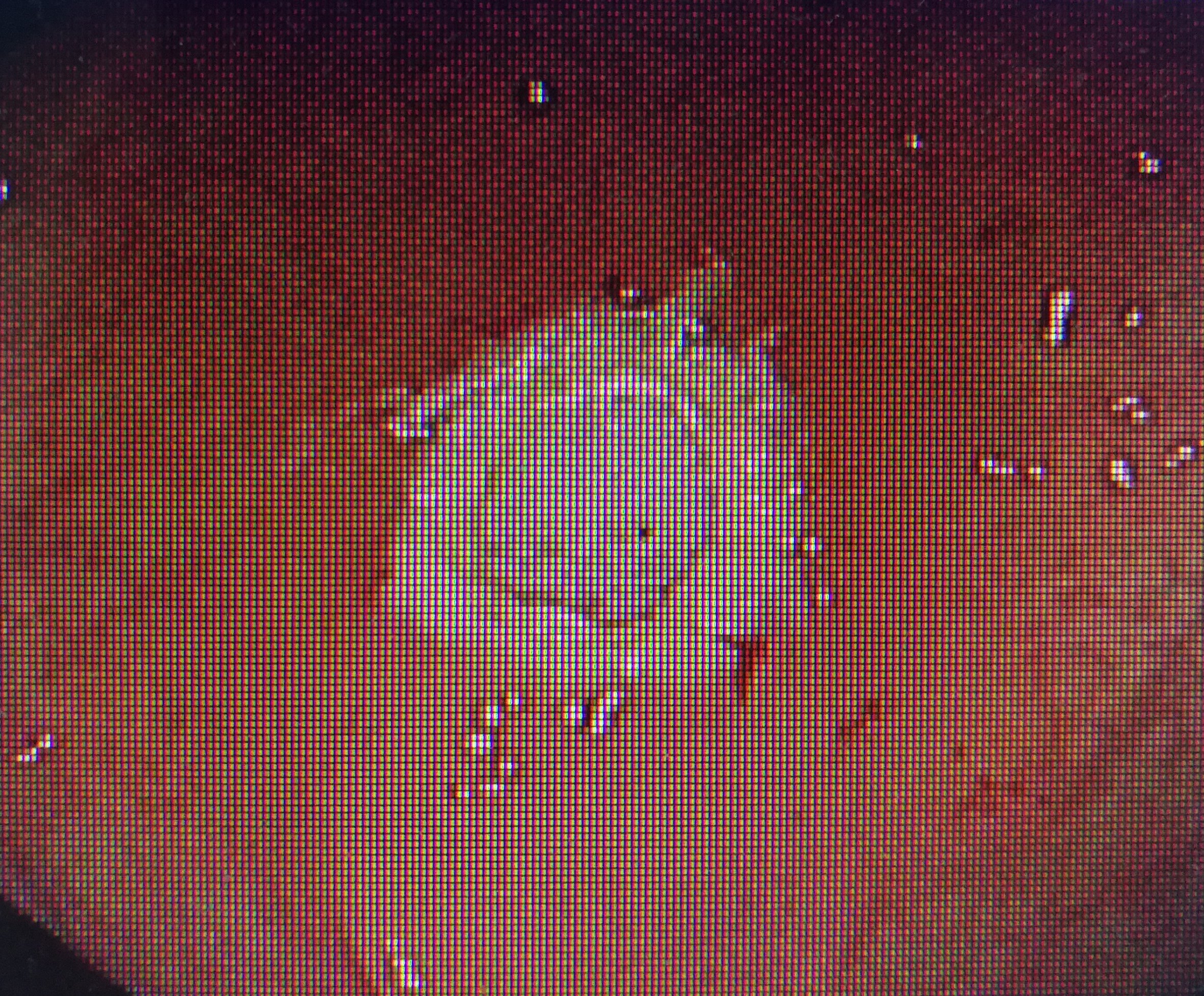 图解直肠息肉的摘除过程