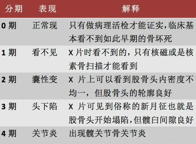 股骨頭壞死應該如何治療?看醫生怎麼說的