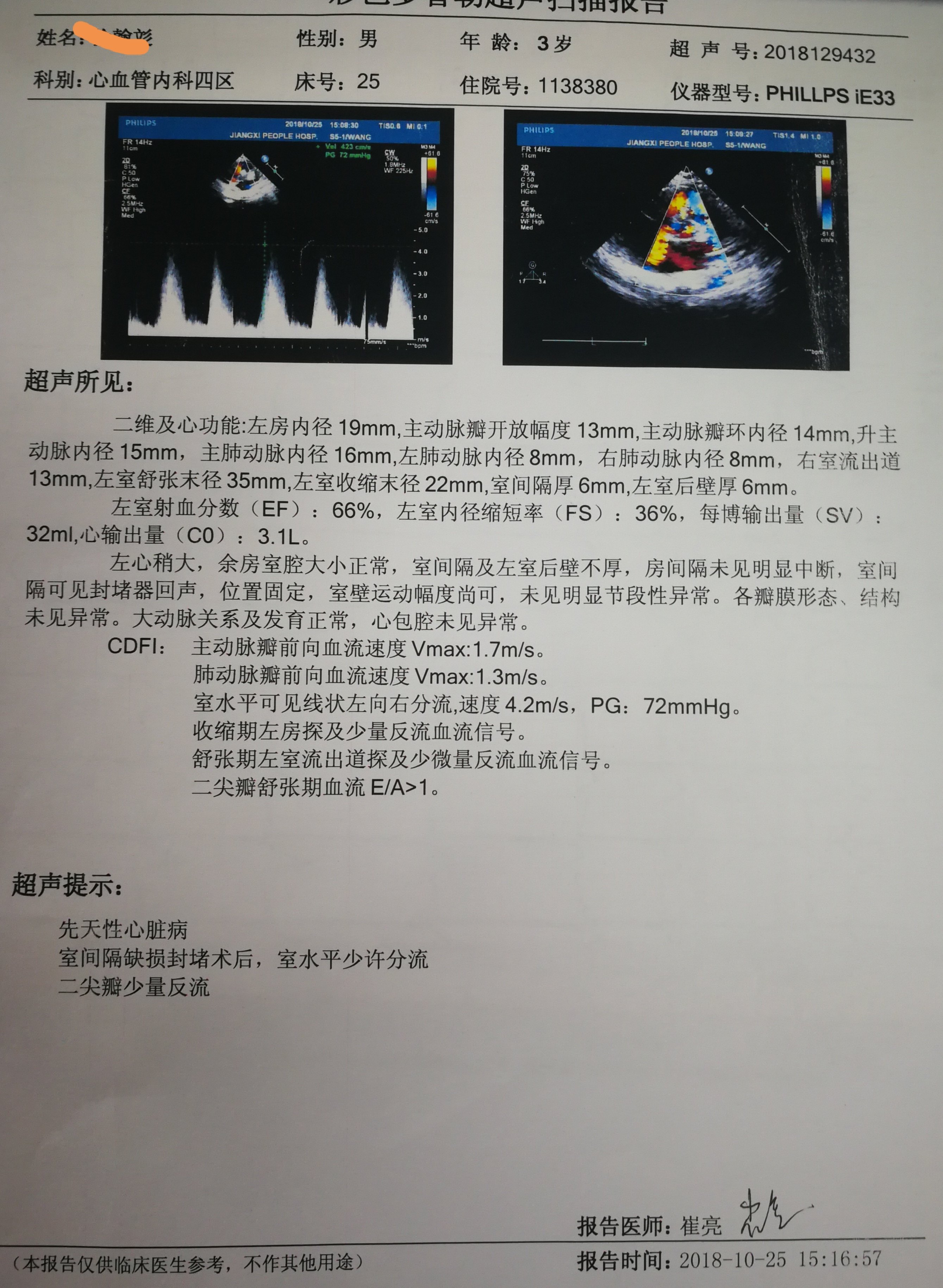 室缺干下型封堵成功