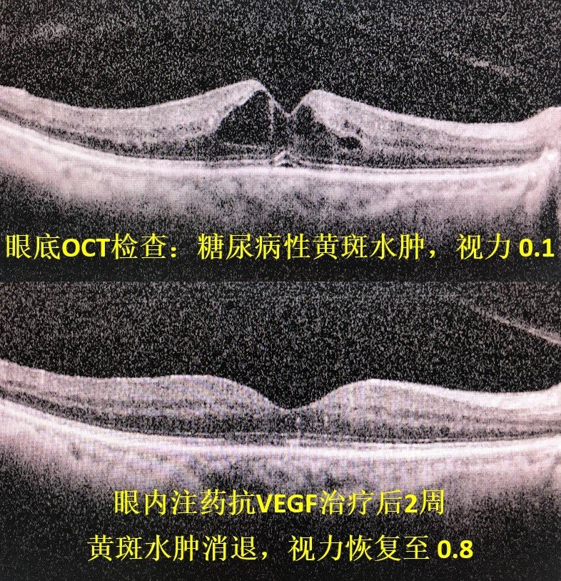 上海市浦东新区人民医院开设眼底病专科门诊 - 好大夫在线