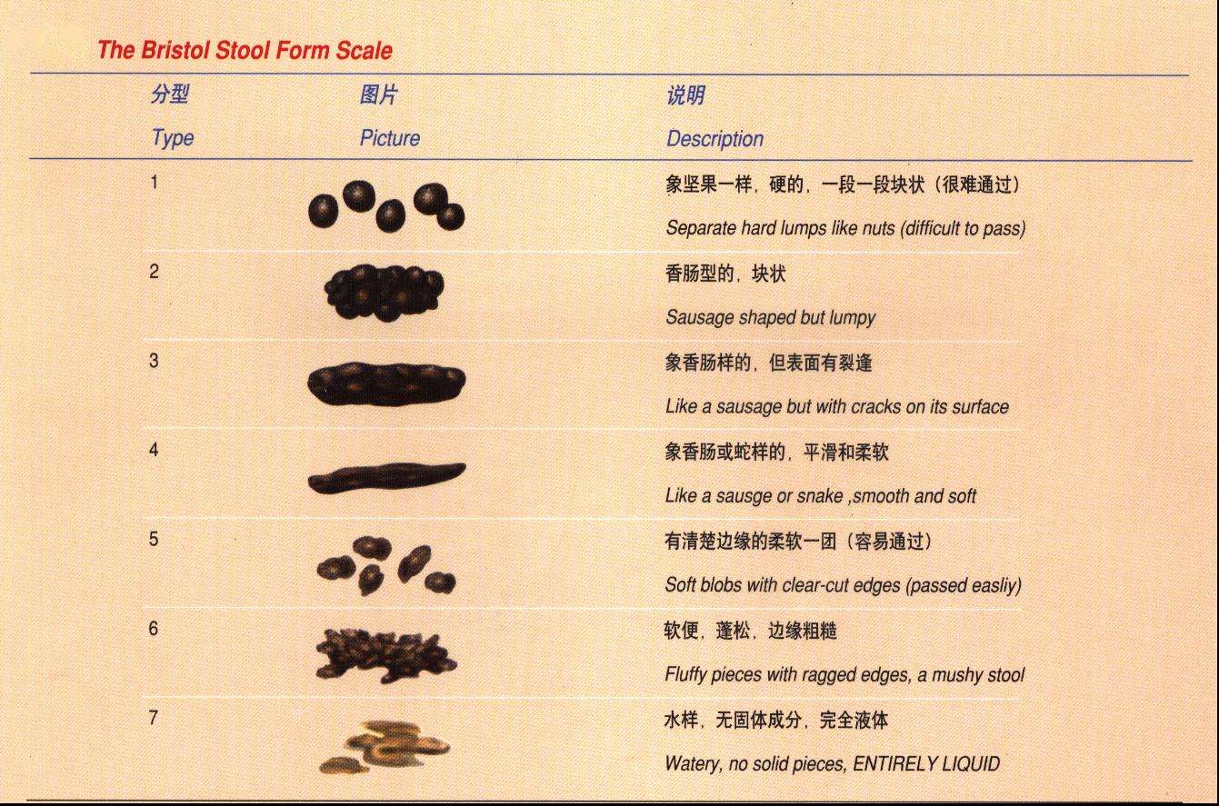 便秘患者大便分型方法