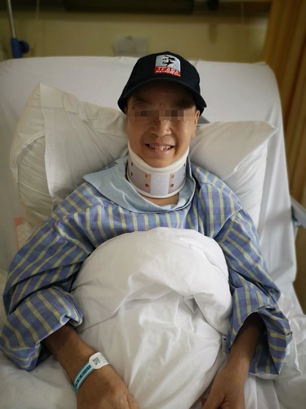 小脑扁桃体下疝畸形之手术治疗