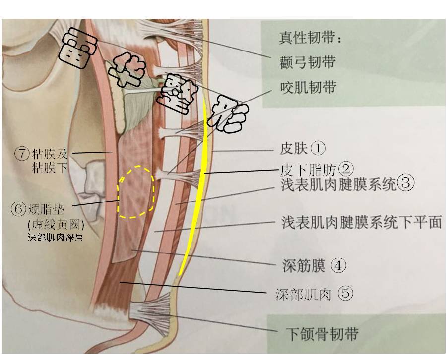 面颊部(脸蛋)组织结构-----面部吸脂效果
