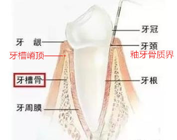 牙齿牙周组织结构_副本.jpg