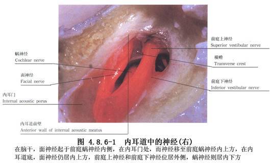 难治性眩晕 梅尼埃病 手术治疗 耳后小切口前庭神经切断术