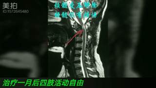 1540200999339130.gif 治疗后.gif