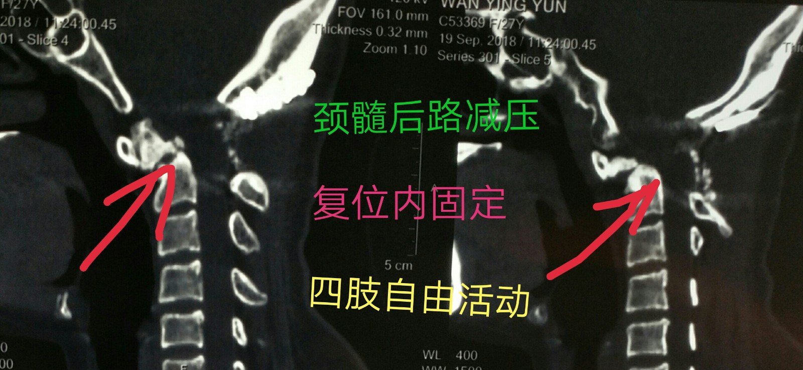 1540200687970436.jpg 4.JPG