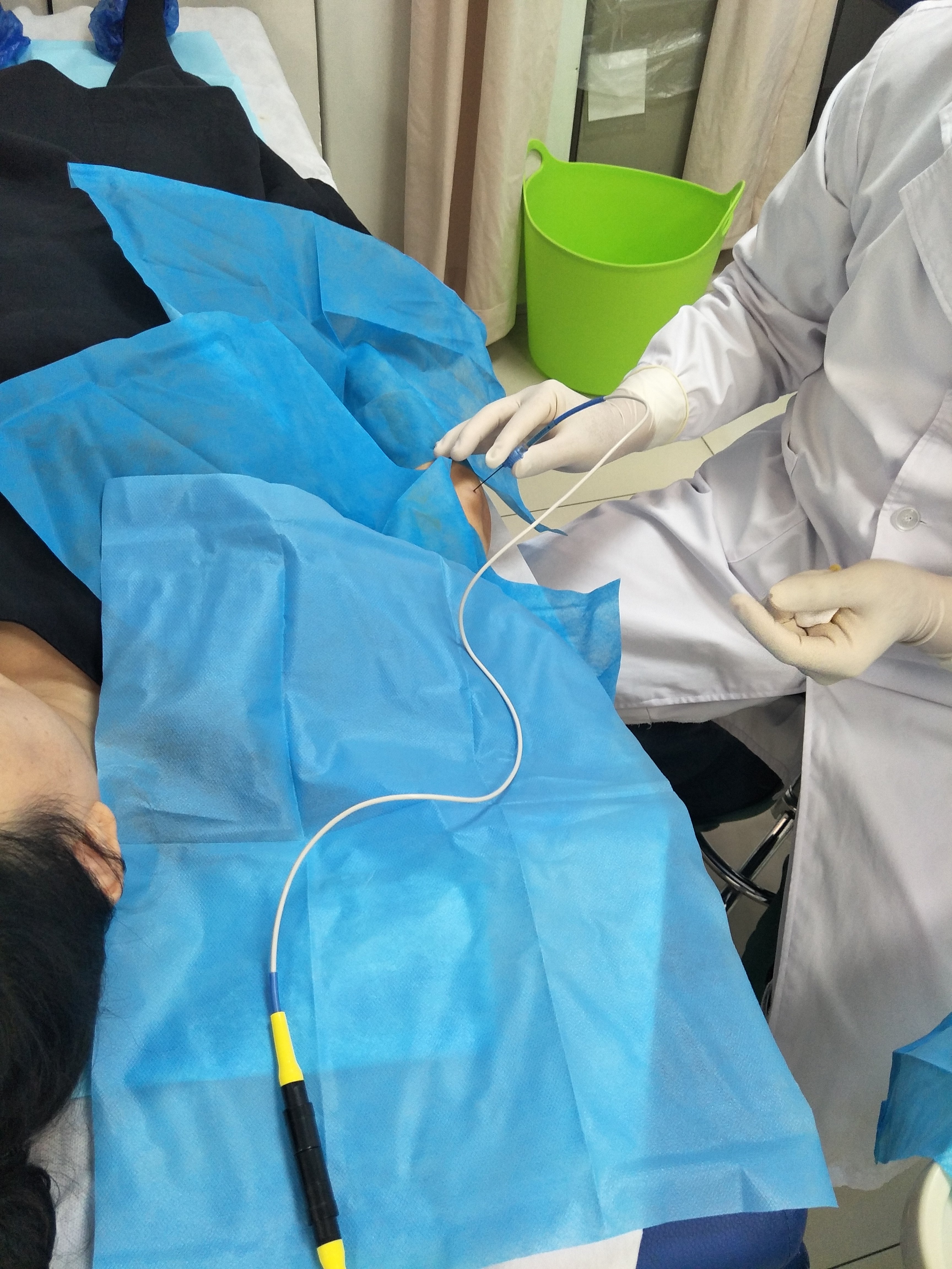 脉冲射频刺激治疗对周围神经病变性疼痛患者的疗效观察