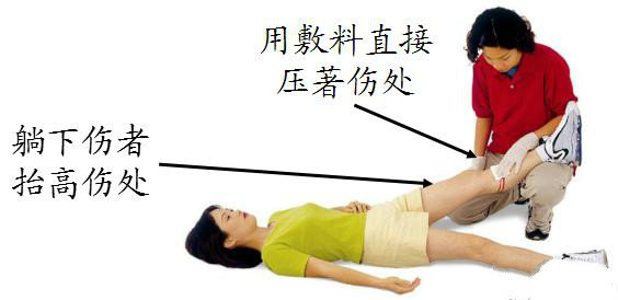 怎么快速止血大伤口 xYYBAFvUWKWAEq3TAABwOYwtRig217.jpg?_ms_=d56b
