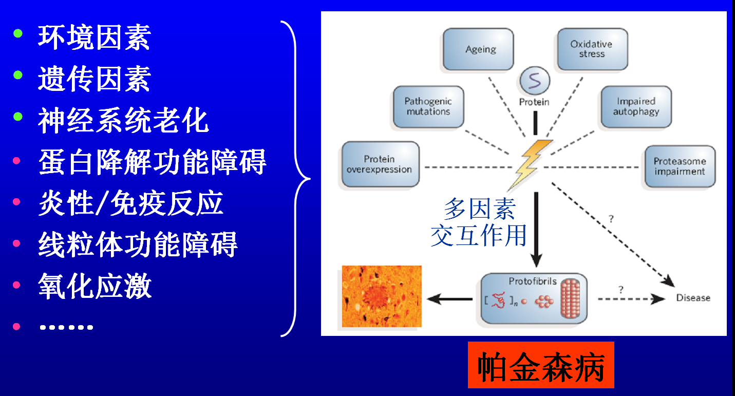 帕金森病的病因