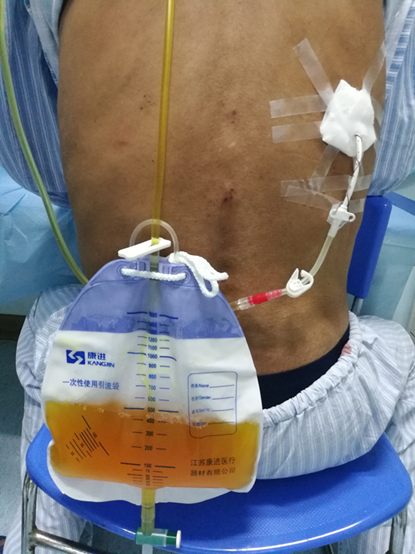 1560002586124233.png image.png