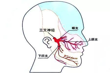 啥是三叉神经 xYYBAF0AVYOARIADAAA3R0IRMNE636.jpg?_ms_=3ba4