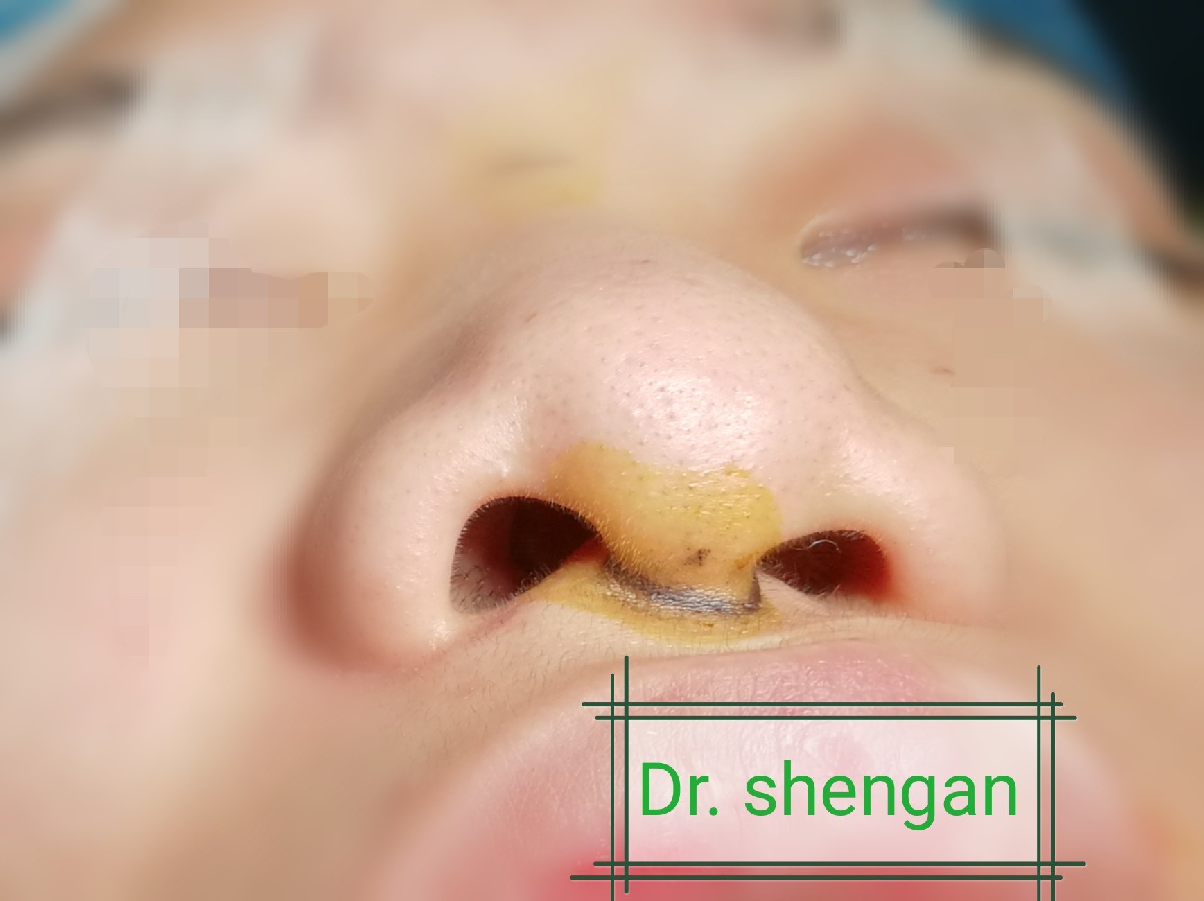 暂无